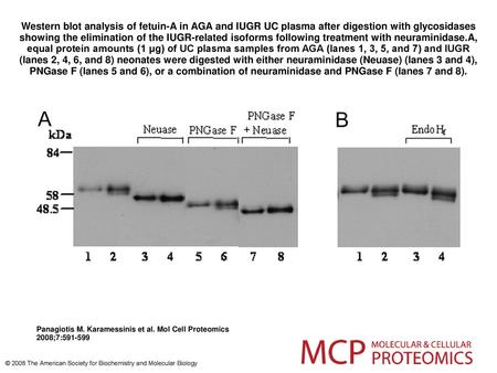 Western blot analysis of fetuin-A in AGA and IUGR UC plasma after digestion with glycosidases showing the elimination of the IUGR-related isoforms following.