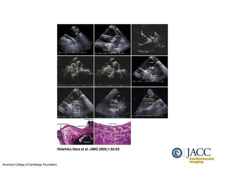 Hidehiko Hara et al. JIMG 2008;1:92-93