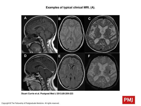 Examples of typical clinical MRI. (A).