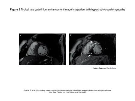 Nat. Rev. Cardiol. doi: /nrcardio