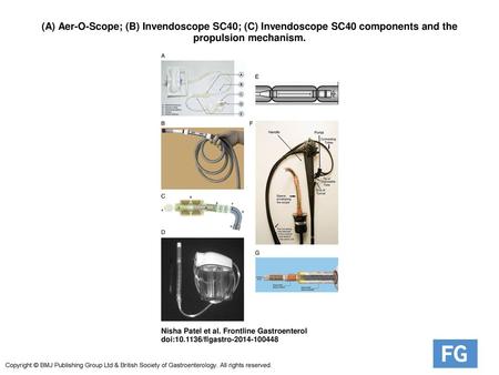 (A) Aer-O-Scope; (B) Invendoscope SC40; (C) Invendoscope SC40 components and the propulsion mechanism. (A) Aer-O-Scope; (B) Invendoscope SC40; (C) Invendoscope.