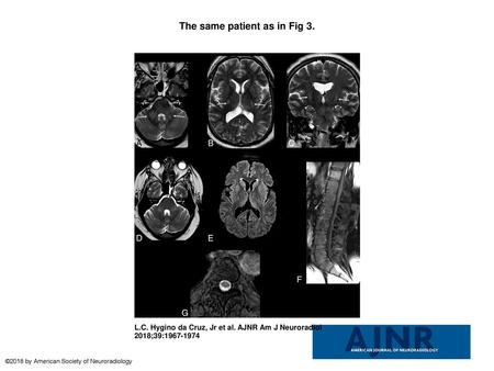 The same patient as in Fig 3.