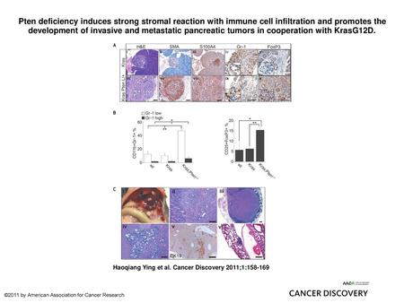 Pten deficiency induces strong stromal reaction with immune cell infiltration and promotes the development of invasive and metastatic pancreatic tumors.