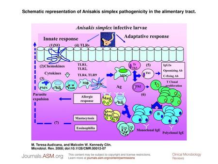 Schematic representation of Anisakis simplex pathogenicity in the alimentary tract. Schematic representation of Anisakis simplex pathogenicity in the alimentary.