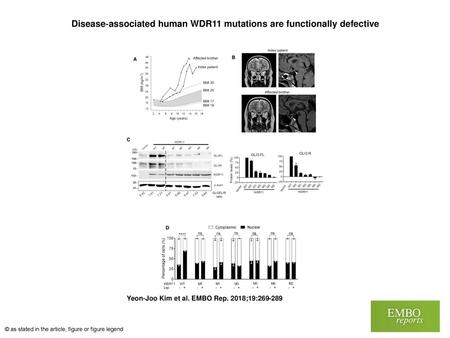 Disease‐associated human WDR11 mutations are functionally defective