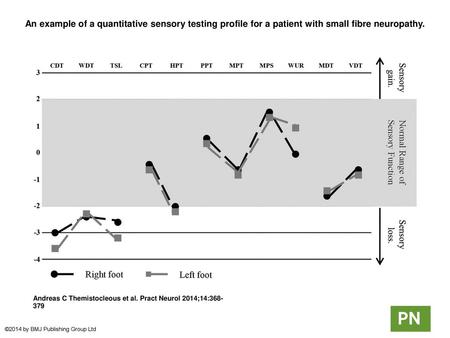 An example of a quantitative sensory testing profile for a patient with small fibre neuropathy. An example of a quantitative sensory testing profile for.