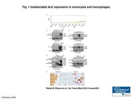 Fig. 1 Undetectable ALK expression in monocytes and macrophages.