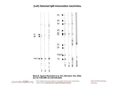 (Left) Selected IgM immunoblot reactivities.