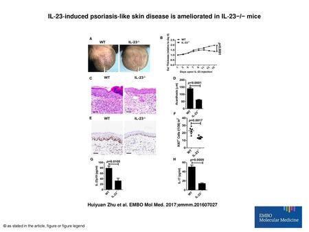 IL‐23‐induced psoriasis‐like skin disease is ameliorated in IL‐23−/− mice IL‐23‐induced psoriasis‐like skin disease is ameliorated in IL‐23−/− mice ARepresentative.