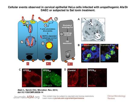 Cellular events observed in cervical epithelial HeLa cells infected with uropathogenic Afa/Dr DAEC or subjected to Sat toxin treatment. Cellular events.