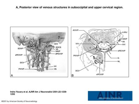 A, Posterior view of venous structures in suboccipital and upper cervical region. A, Posterior view of venous structures in suboccipital and upper cervical.