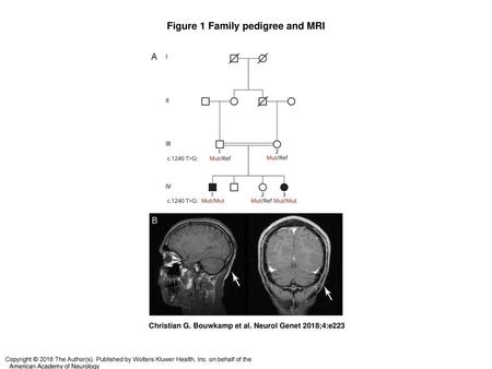 Figure 1 Family pedigree and MRI