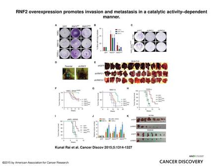 RNF2 overexpression promotes invasion and metastasis in a catalytic activity–dependent manner. RNF2 overexpression promotes invasion and metastasis in.