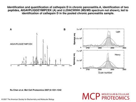 Identification and quantification of cathepsin D in chronic pancreatitis.A, identification of two peptides, AIGAVPLIQGEYMIPCEK (A) and LLDIACWIHH (MS/MS.