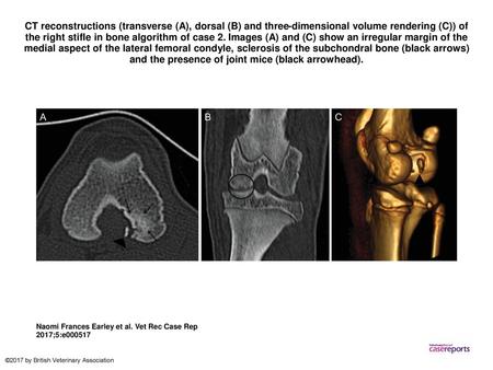 CT reconstructions (transverse (A), dorsal (B) and three-dimensional volume rendering (C)) of the right stifle in bone algorithm of case 2. Images (A)