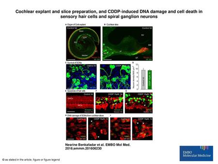 Cochlear explant and slice preparation, and CDDP‐induced DNA damage and cell death in sensory hair cells and spiral ganglion neurons Cochlear explant and.