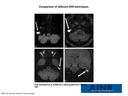 Comparison of different DWI techniques.