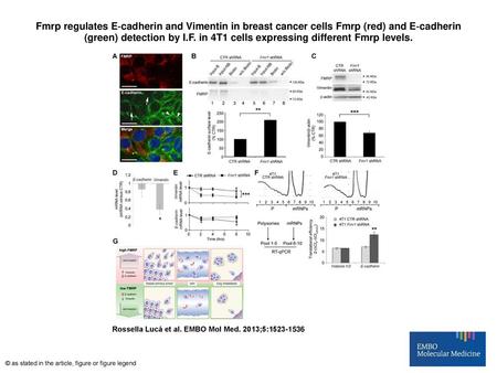 Fmrp regulates E‐cadherin and Vimentin in breast cancer cells Fmrp (red) and E‐cadherin (green) detection by I.F. in 4T1 cells expressing different Fmrp.