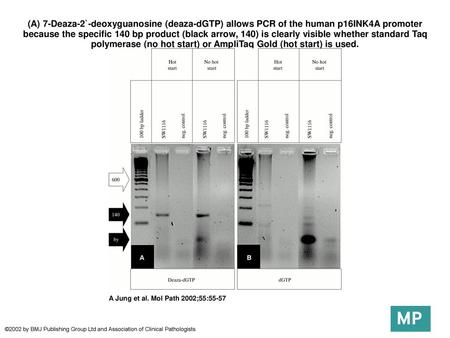 (A) 7-Deaza-2`-deoxyguanosine (deaza-dGTP) allows PCR of the human p16INK4A promoter because the specific 140 bp product (black arrow, 140) is clearly.