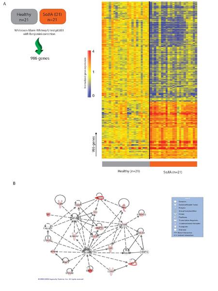 Differential gene expression in whole blood from SJIA patients and healthy controls. A. Data were normalized in Beadstudio using the average method and.