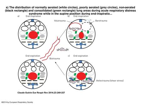 A) The distribution of normally aerated (white circles), poorly aerated (grey circles), non-aerated (black rectangle) and consolidated (green rectangle)