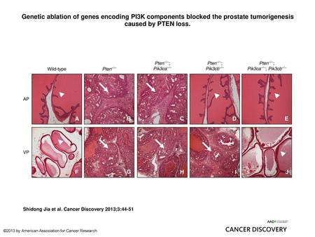 Genetic ablation of genes encoding PI3K components blocked the prostate tumorigenesis caused by PTEN loss. Genetic ablation of genes encoding PI3K components.