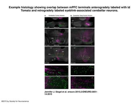 Example histology showing overlap between mPFC terminals anterogradely labeled with td Tomato and retrogradely labeled eyeblink-associated cerebellar neurons.