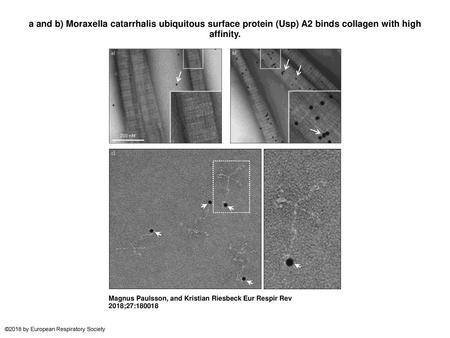 A and b) Moraxella catarrhalis ubiquitous surface protein (Usp) A2 binds collagen with high affinity. a and b) Moraxella catarrhalis ubiquitous surface.