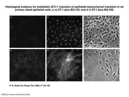 Histological evidence for endothelin (ET)-1 induction of epithelial-mesenchymal transition in rat primary distal epithelial cells. a–c) ET-1 plus BQ-123,