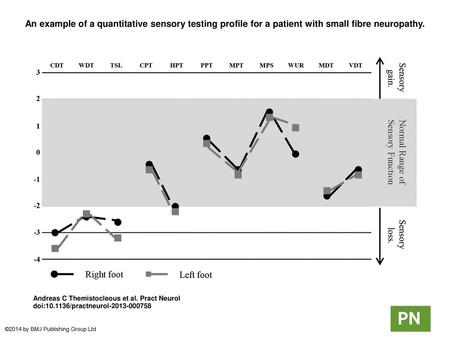 An example of a quantitative sensory testing profile for a patient with small fibre neuropathy. An example of a quantitative sensory testing profile for.