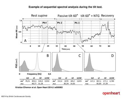 Example of sequential spectral analysis during the tilt test.