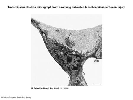 Transmission electron micrograph from a rat lung subjected to ischaemia/reperfusion injury. Transmission electron micrograph from a rat lung subjected.