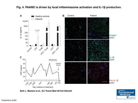 PAAND is driven by local inflammasome activation and IL-1β production