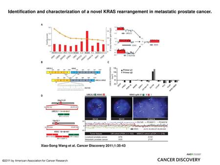 Identification and characterization of a novel KRAS rearrangement in metastatic prostate cancer. Identification and characterization of a novel KRAS rearrangement.