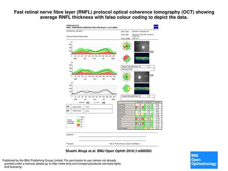 Fast retinal nerve fibre layer (RNFL) protocol optical coherence tomography (OCT) showing average RNFL thickness with false colour coding to depict the.