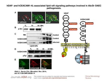 HDAF- and hCEACAM1-4L-associated lipid raft signaling pathways involved in Afa/Dr DAEC pathogenesis. hDAF- and hCEACAM1-4L-associated lipid raft signaling.