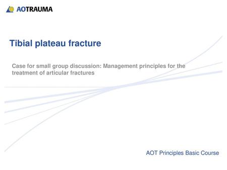 Tibial plateau fracture