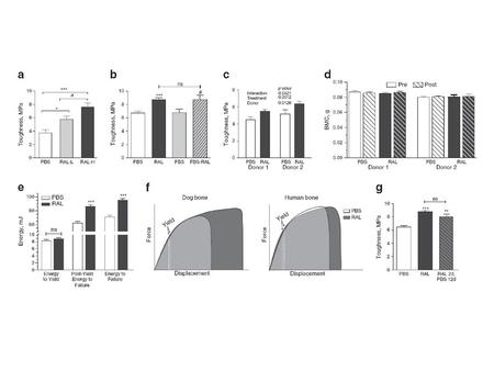 Bone 2014;61:191 (Fig. 2) Reproduced from Bone, 61:191-200, Copyright (2014), with permission from Elsevier.