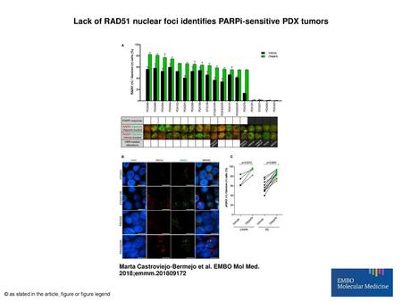 Lack of RAD51 nuclear foci identifies PARPi‐sensitive PDX tumors