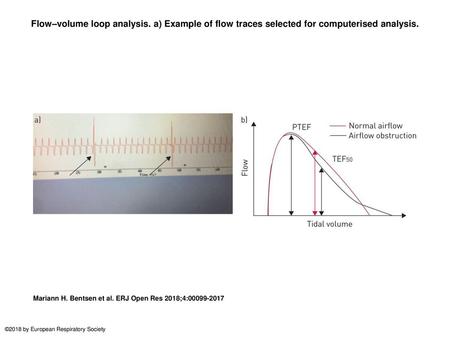 Flow–volume loop analysis