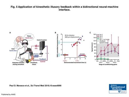 Fig. 5 Application of kinesthetic illusory feedback within a bidirectional neural-machine interface. Application of kinesthetic illusory feedback within.