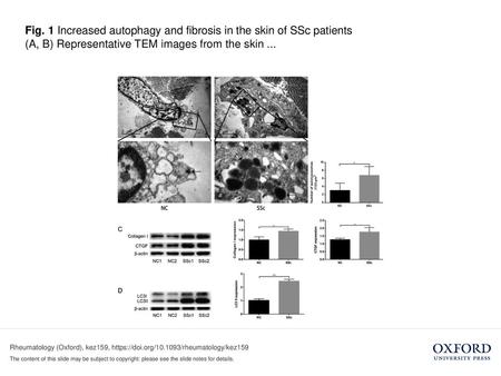 (A, B) Representative TEM images from the skin ...