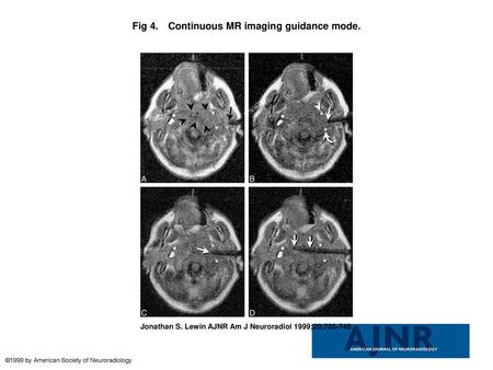 Fig 4. Continuous MR imaging guidance mode.