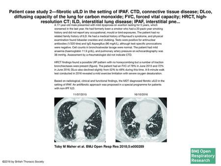 Patient case study 2—fibrotic uILD in the setting of IPAF