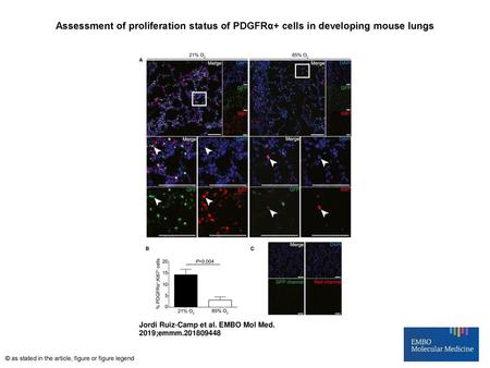 Assessment of proliferation status of PDGFRα+ cells in developing mouse lungs Assessment of proliferation status of PDGFRα+ cells in developing mouse lungs.