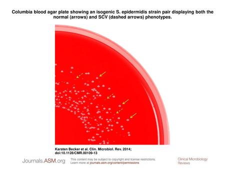 Columbia blood agar plate showing an isogenic S