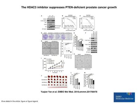 The HDAC3 inhibitor suppresses PTEN‐deficient prostate cancer growth