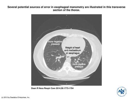 Several potential sources of error in esophageal manometry are illustrated in this transverse section of the thorax. Several potential sources of error.