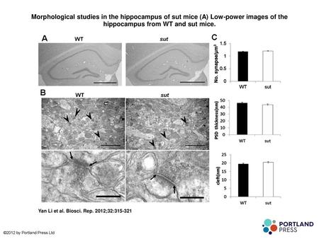 Morphological studies in the hippocampus of sut mice (A) Low-power images of the hippocampus from WT and sut mice. Morphological studies in the hippocampus.