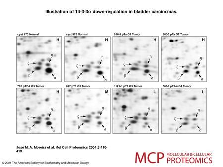 Illustration of σ down-regulation in bladder carcinomas.